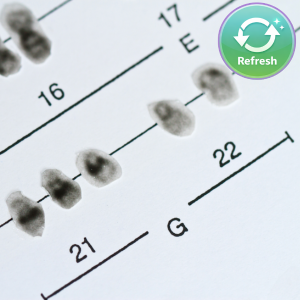 Prenatal Screening and Down syndrome